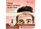 Restore Your Confidence with the Top Hair Transplant Clinic